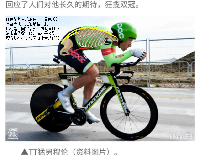 腹直肌上固定使骨盆后倾