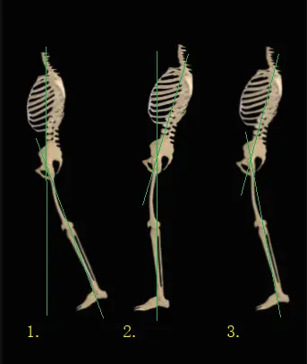 近固定，远固定，无固定的三种伸髋