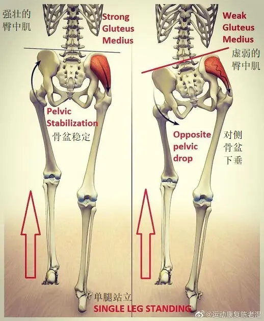 图来自运动康复陈老师