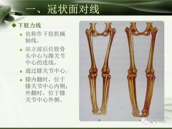 冠状面下肢力线（来自网络）